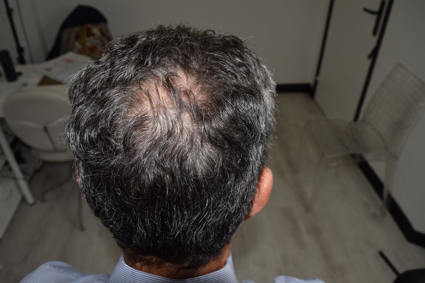 Tricopigmentation