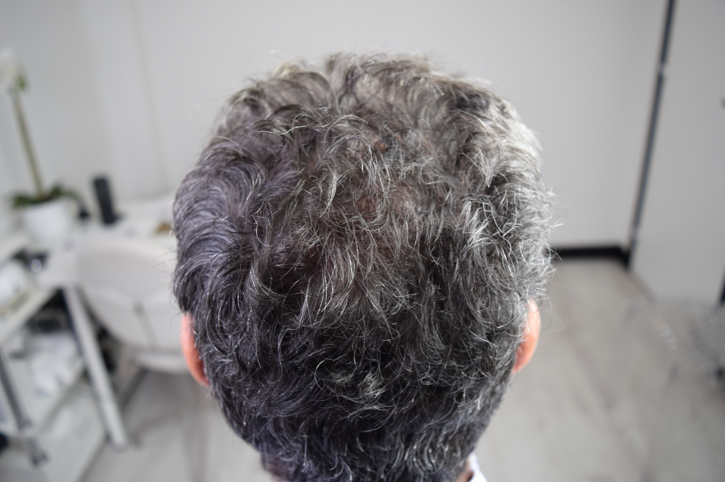 Tricopigmentation