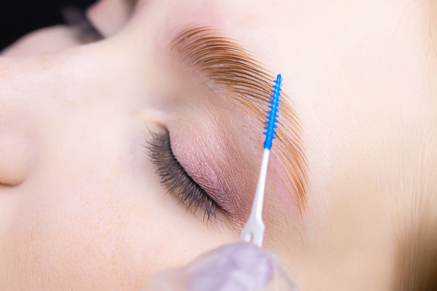 Brow Lift
