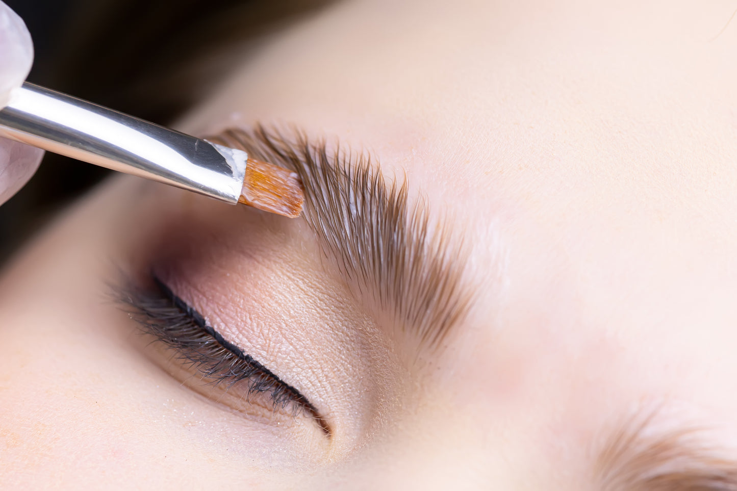 Brow Lift
